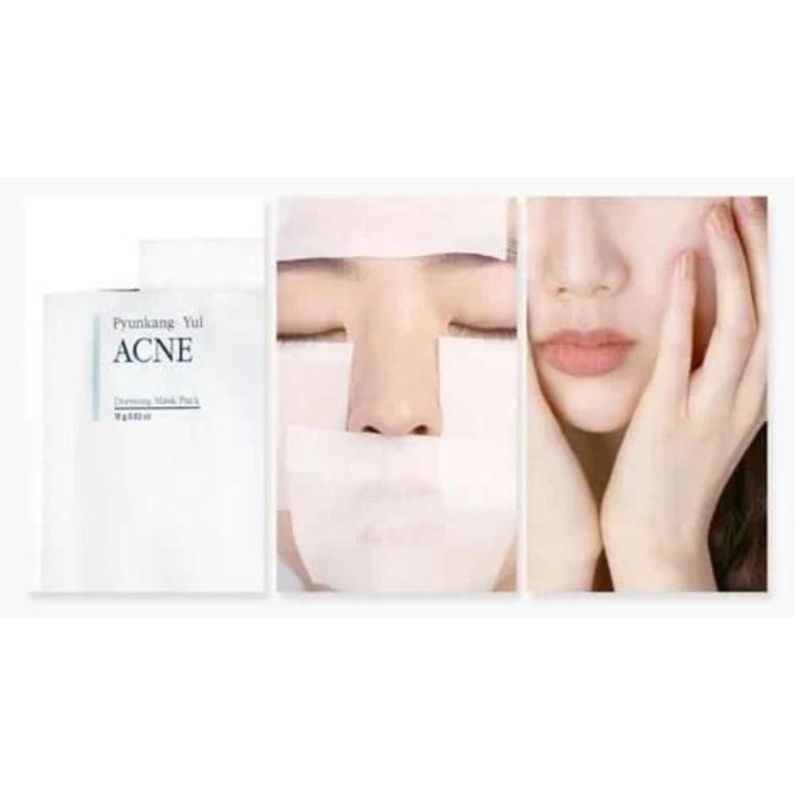Masca de fata pentru tenul acneic Acne Dressing Mask Pack, 18g, Pyunkang Yul - blively.ro